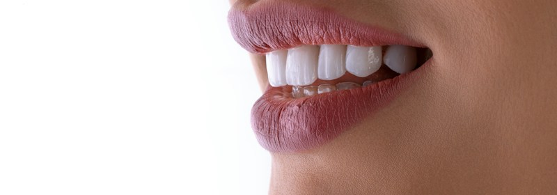 Estetica dentale nello studio odontoiatrico a Fulgatore